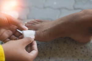 Causes and Safe Treatment of Foot Blisters