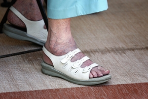Foot Conditions Among Elderly People