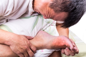 Understanding the Causes of Gout